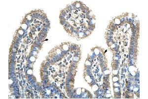 NXF5 antibody was used for immunohistochemistry at a concentration of 4-8 ug/ml to stain Epithelial cells of intestinal villus (arrows) in Human Intestine. (NXF5 抗体  (Middle Region))