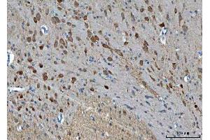 IHC analysis of TSR2 using anti-TSR2 antibody (ABIN7599035).
