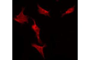 Immunofluorescence (fixed cells) (IF/ICC) image for anti-Membrane Associated Guanylate Kinase, WW and PDZ Domain Containing 2 (MAGI2) (N-Term) antibody (ABIN6256894)