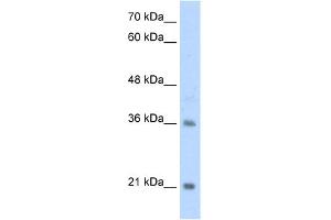WB Suggested Anti-TCF15 Antibody Titration:  2. (TCF15 抗体  (N-Term))