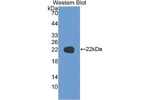 Western blot analysis of the recombinant protein. (KRT17 抗体  (AA 252-393))