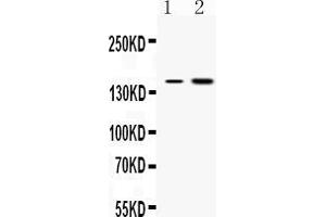 Western blot analysis of Insulin Receptor expression in rat kidney extract ( Lane 1) and HEPG2 whole cell lysates ( Lane 2). (Insulin Receptor 抗体  (N-Term))