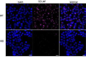 Immunocytochemical staining of HeLa cells using GOLM1 antibody (ABIN7798793), 1:1,000), Top panel: wild-type (WT), Bottom panal: GOLM1 shRNA knockdown (KD).