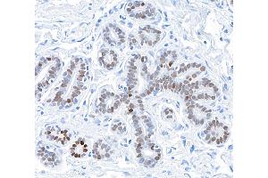 Immunohistochemistry (IHC) image for anti-GATA Binding Protein 3 (GATA3) (AA 150-200) antibody (ABIN7455153) (Recombinant GATA3 抗体  (AA 150-200))