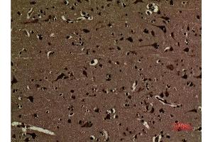 Immunohistochemistry (IHC) analysis of paraffin-embedded Human Brain, antibody was diluted at 1:100. (Histone 3 抗体  (2meLys5))