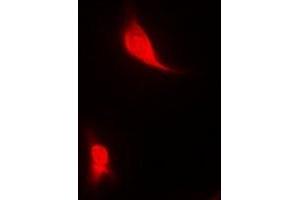 Immunofluorescent analysis of EGLN1 staining in MCF7 cells. (EGLN1 抗体)