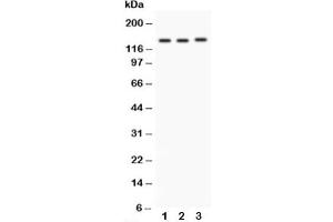 Western blot testing of Integrin alpha 1 antibody and Lane 1:  rat brain (Integrin alpha 1 抗体  (C-Term))