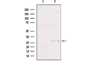Western blot analysis of extracts from Hepg2, using FMR1NB Antibody. (FMR1NB 抗体  (C-Term))