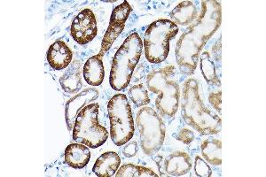 Immunohistochemistry (IHC) image for anti-Sirtuin 3 (SIRT3) (C-Term) antibody (ABIN6147792)