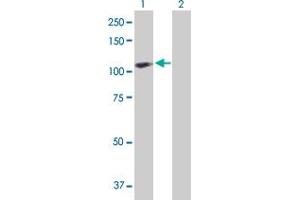 Western Blot analysis of ACAP2 expression in transfected 293T cell line by ACAP2 MaxPab polyclonal antibody. (Centaurin beta 2 抗体  (AA 1-778))