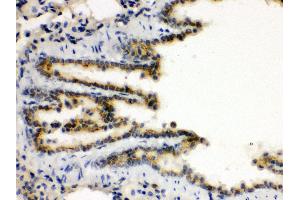 Anti- XBP Picoband antibody, IHC(P) IHC(P): Rat Lung Tissue (XBP1 抗体  (N-Term))