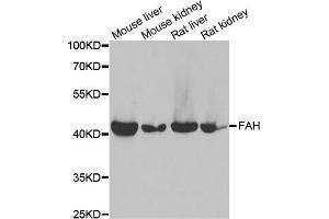 Western blot analysis of extracts of various cell lines, using FAH antibody.