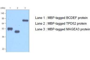 Western Blotting (WB) image for anti-MBP Tag antibody (ABIN317540) (MBP Tag 抗体)
