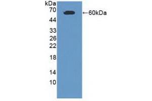 Detection of Recombinant CADM1, Human using Polyclonal Antibody to Cell Adhesion Molecule 1 (CADM1) (CADM1 抗体  (AA 27-292))