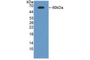 Detection of Recombinant CADM1, Human using Polyclonal Antibody to Cell Adhesion Molecule 1 (CADM1) (CADM1 抗体  (AA 27-292))