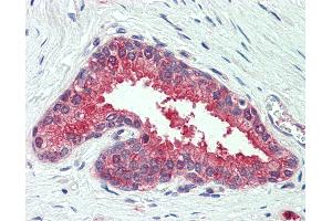 Anti-SLC12A2 / NKCC1 antibody IHC of human prostate.