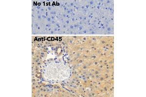 Immunohistochemistry (IHC) image for anti-Protein tyrosine Phosphatase, Receptor Type, C (PTPRC) (C-Term) antibody (ABIN6254211) (CD45 抗体  (C-Term))