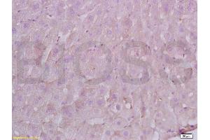 Formalin-fixed and paraffin embedded Rat liver labeled with Anti-FBN1/fibrillin 1 Polyclonal Antibody, Unconjugated (ABIN738501) at 1:200 followed by conjugation to the secondary antibody and DAB staining. (Fibrillin 1 抗体  (AA 401-500))