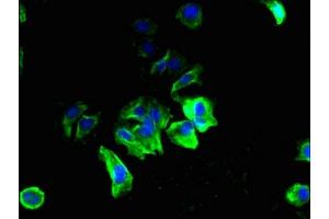 Immunofluorescent analysis of MCF-7 cells using ABIN7169736 at dilution of 1:100 and Alexa Fluor 488-congugated AffiniPure Goat Anti-Rabbit IgG(H+L) (C12orf69 抗体  (AA 1-154))