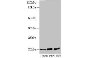 Western blot All lanes: TPRKB antibody at 5 μg/mL Lane 1: A549 whole cell lysate Lane 2: Jurkat whole cell lysate Lane 3: MCF-7 whole cell lysate Secondary Goat polyclonal to rabbit IgG at 1/10000 dilution Predicted band size: 20, 17, 24 kDa Observed band size: 20 kDa (TPRKB 抗体  (AA 1-175))