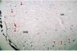 Expression of Neurotrophin 4 in mouse spinal cord - Immunohistochemical staining of mouse spinal cord using Anti-Neurotrophin 4 (NT-4) Antibody (ABIN7043393 and ABIN7044750). (Neurotrophin 4 抗体  (Intracellular))