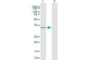 Western Blot analysis of BCOR expression in transfected 293T cell line by BCOR polyclonal antibody (A01). (BCOR 抗体  (AA 1361-1460))
