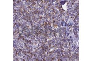 ABIN6268692 at 1/100 staining human Lymph node tissues sections by IHC-P. (IL-8 抗体  (Internal Region))