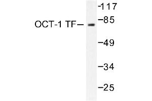 Image no. 2 for anti-POU Domain, Class 2, Transcription Factor 1 (POU2F1) antibody (ABIN271753) (POU2F1 抗体)