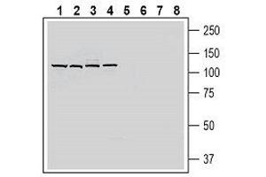 Western Blotting (WB) image for anti-Solute Carrier Family 19 (Folate Transporter), Member 1 (SLC19A1) (AA 412-426), (Extracellular) antibody (ABIN7043690)