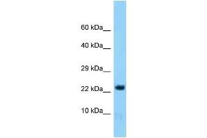 Western Blotting (WB) image for anti-Histidine Triad Nucleotide Binding Protein 2 (HINT2) (Middle Region) antibody (ABIN2788383) (HINT2 抗体  (Middle Region))