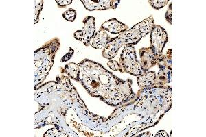 IHC analysis of SNRNP40 using anti-SNRNP40 antibody (ABIN7601719). (SNRNP40 抗体  (AA 43-357))