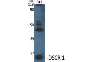 Western Blot (WB) analysis of specific cells using DSCR 1 Polyclonal Antibody. (RCAN1 抗体  (C-Term))