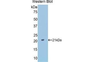 Western blot analysis of the recombinant protein. (PPARD 抗体  (AA 260-426))
