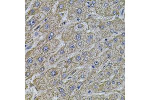 Immunohistochemistry of paraffin-embedded human liver injury using MAP1B antibody (ABIN5971696) at dilution of 1/100 (40x lens). (MAP1B 抗体)