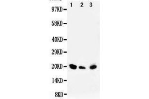 Anti-DUSP3 antibody, Western blotting Lane 1: Rat Testis Tissue Lysate Lane 2: SKOV Cell Lysate Lane 3: MM453 Cell Lysate (Dual Specificity Phosphatase 3 (DUSP3) (AA 155-171), (C-Term) 抗体)