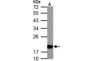 WB Image NDUFS4 antibody detects NDUFS4 protein by Western blot analysis. (NDUFS4 抗体  (Center))