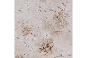 Immunohistochemical staining of human hippocampus with PLEKHF1 polyclonal antibody  shows strong cytoplasmic positivity in astrocyte-like cells. (PLEKHF1 抗体)