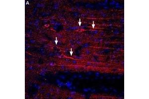 Expression of CXCR4 in rat brain - Immunohistochemical staining of rat temporal cortex using Anti-CXCR4 (extracellular) Antibody (ABIN7043040, ABIN7044166 and ABIN7044167), (1:400) followed by donkey anti-rabbit-biotin and streptavidin labeled with Cy3. (CXCR4 抗体  (Extracellular))