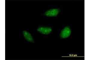 Immunofluorescence of purified MaxPab antibody to NOL6 on HeLa cell. (Nucleolar Protein 6 抗体  (AA 1-200))