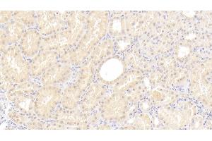 Detection of C8g in Human Kidney Tissue using Polyclonal Antibody to Complement Component 8g (C8g) (C8G 抗体  (AA 39-202))