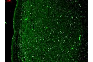 Immunohistochemistry (IHC) image for anti-Potassium Voltage-Gated Channel, KQT-Like Subfamily, Member 4 (KCNQ4) (AA 2-77) antibody (ABIN361768)