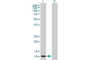 Western Blot analysis of TIMM8A expression in transfected 293T cell line by TIMM8A MaxPab polyclonal antibody. (TIMM8A/DDP 抗体  (AA 1-97))