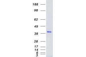 Western Blotting (WB) image for Mitogen-Activated Protein Kinase Kinase 4 (MAP2K4) protein (Myc-DYKDDDDK Tag) (ABIN2725393)