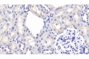 Immunohistochemistry (IHC) image for anti-Angiotensinogen (serpin Peptidase Inhibitor, Clade A, Member 8) (AGT) (AA 25-477) antibody (ABIN7432631)