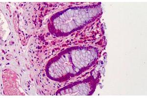 Human Colon: Formalin-Fixed, Paraffin-Embedded (FFPE) (GNAS 抗体  (AA 164-394))
