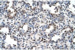 Immunohistochemical staining (Formalin-fixed paraffin-embedded sections) of human lung with FAM134B polyclonal antibody  at 4-8 ug/mL working concentration. (FAM134B 抗体  (Internal Region))