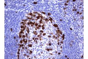 Image no. 2 for anti-Thymidylate Synthetase (TYMS) antibody (ABIN1501589) (TYMS 抗体)
