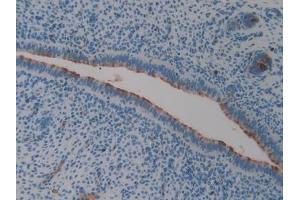 Immunohistochemistry (IHC) image for anti-Clusterin (CLU) (AA 227-448) antibody (ABIN7433225)