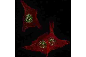 Immunofluorescence (IF) image for anti-Fibroblast Growth Factor Receptor 4 (FGFR4) antibody (ABIN2929142) (FGFR4 抗体)