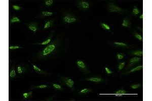 Immunofluorescence of monoclonal antibody to ZBTB25 on HeLa cell. (ZBTB25 抗体  (AA 331-435))